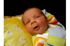 Bebeklerde Sarılık Belirtileri ve Tedavisi