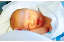 Yeni Doğan Sarılığı Nedir? Nasıl Oluşur